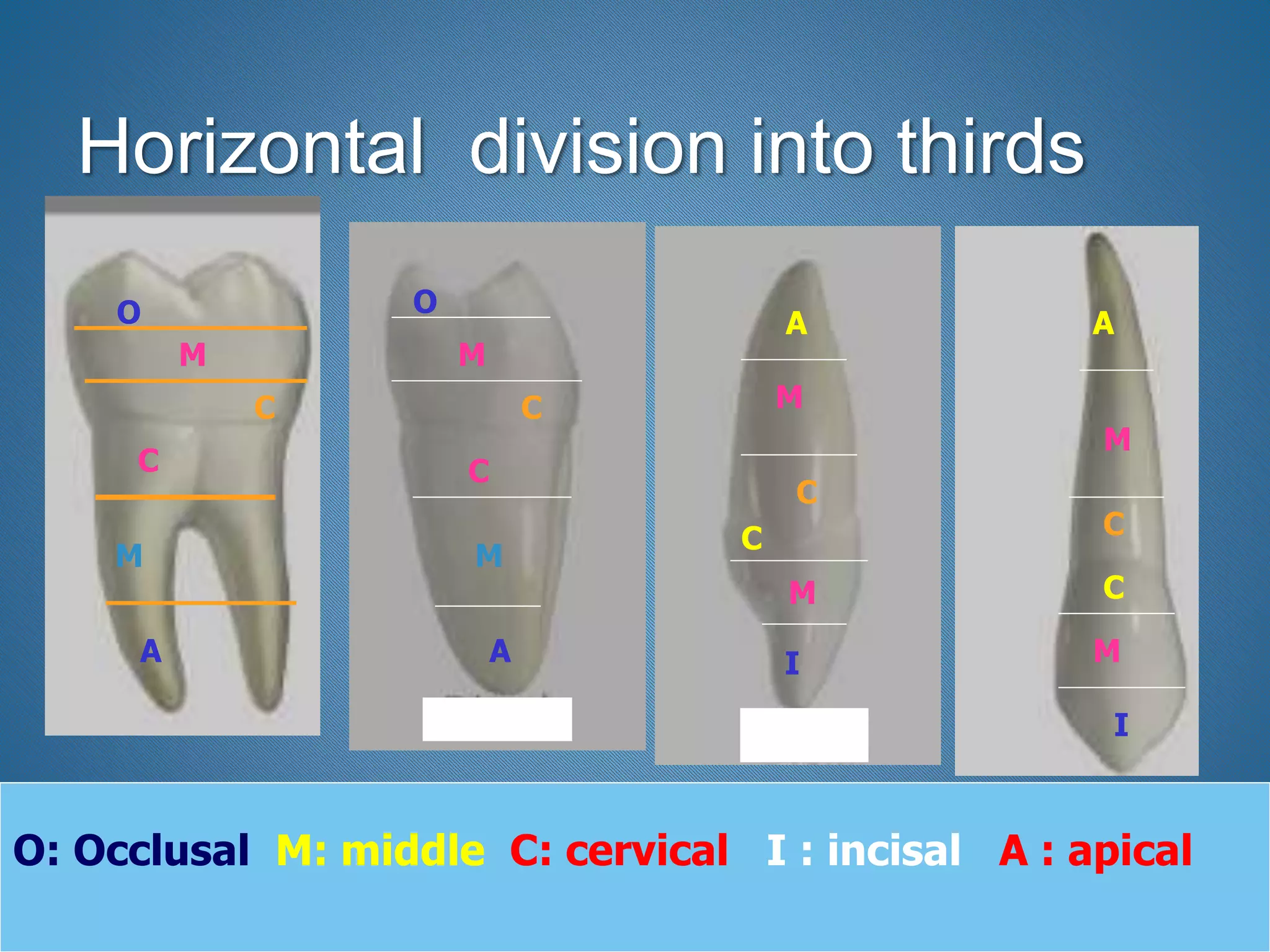 Horizontal division into thirds
O
M
C
C
M
A
O
M
C
C
M
A I
M
C
M
C
A
I
M
C
C
M
A
O: Occlusal M: middle C: cervical I : incisal A : apical
 