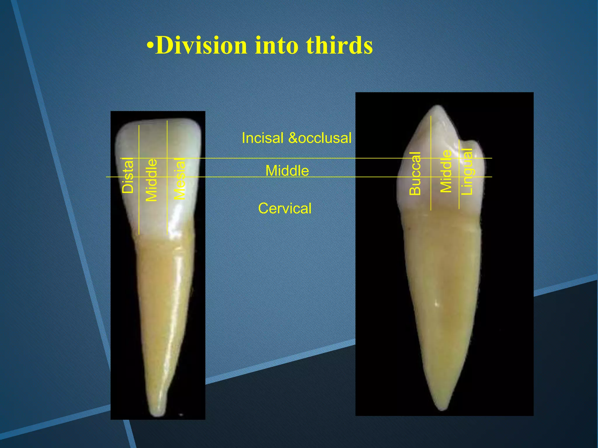 Middle
Middle
Mesial
Buccal
Lingual
Incisal &occlusal
Middle
Cervical
•Division into thirds
Distal
 