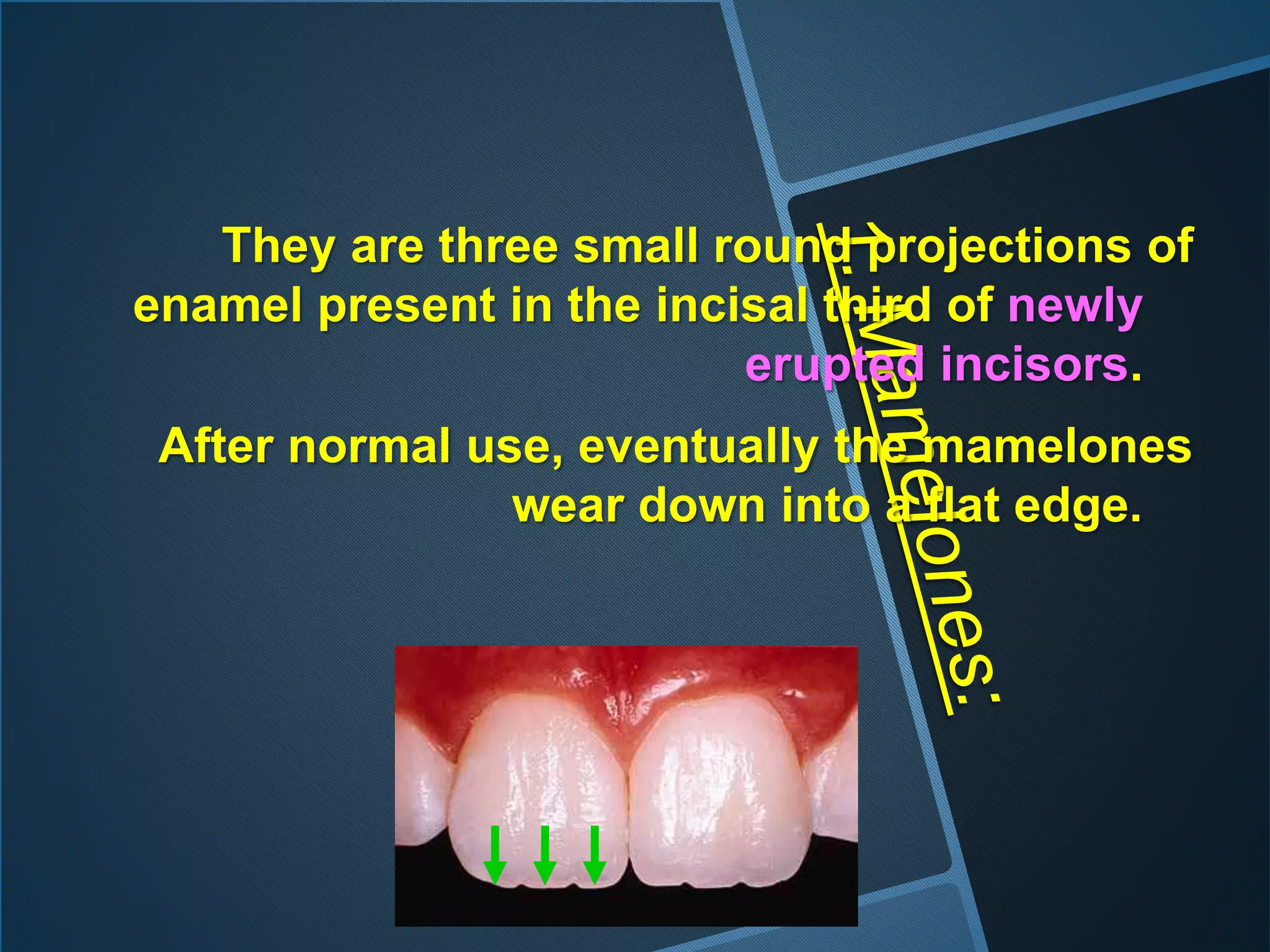 They are three small round projections of
enamel present in the incisal third of newly
erupted incisors.
After normal use, eventually the mamelones
wear down into a flat edge.
 