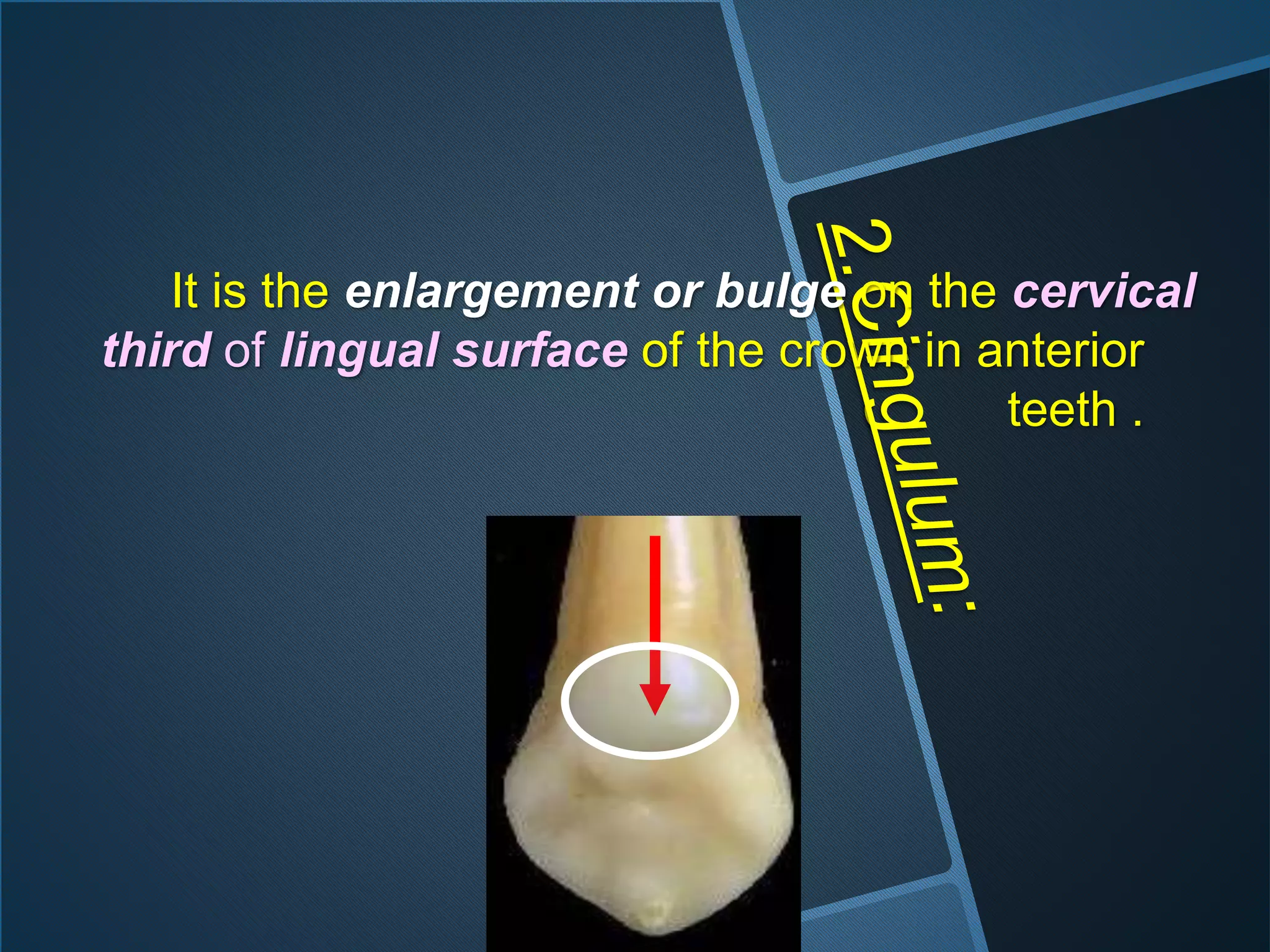 It is the enlargement or bulge on the cervical
third of lingual surface of the crown in anterior
teeth .
 