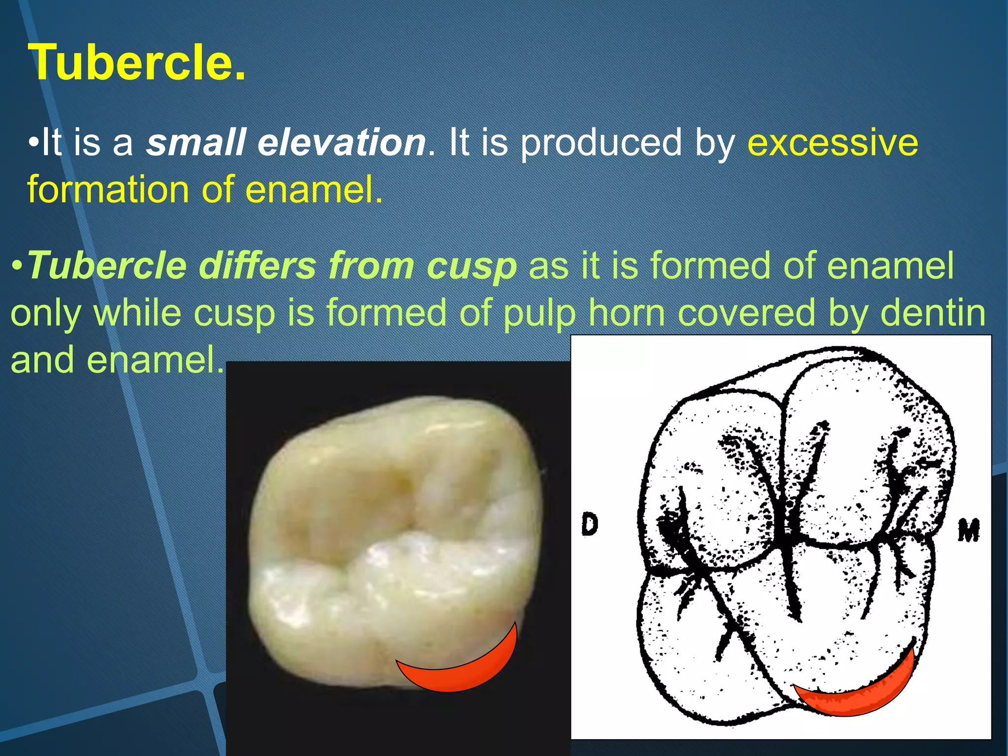 Tubercle.
•It is a small elevation. It is produced by excessive
formation of enamel.
•Tubercle differs from cusp as it is formed of enamel
only while cusp is formed of pulp horn covered by dentin
and enamel.
 