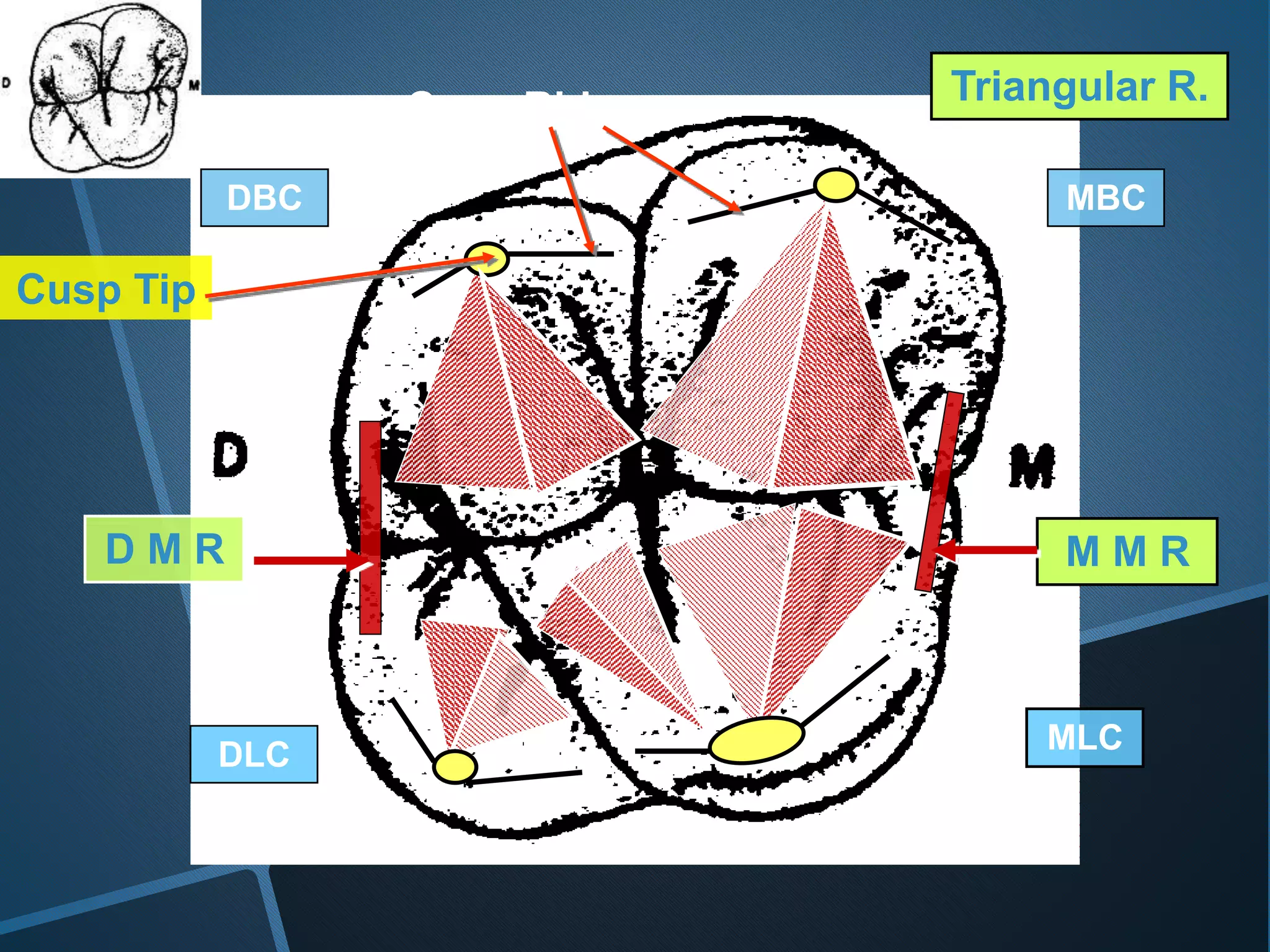 Triangular R.
Cusp Tip
M M RD M R
Cusp Ridges
MBC
MLCDLC
DBC
 