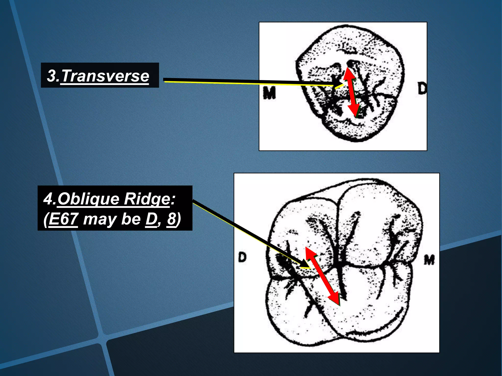 3.Transverse
4.Oblique Ridge:
(E67 may be D, 8)
 
