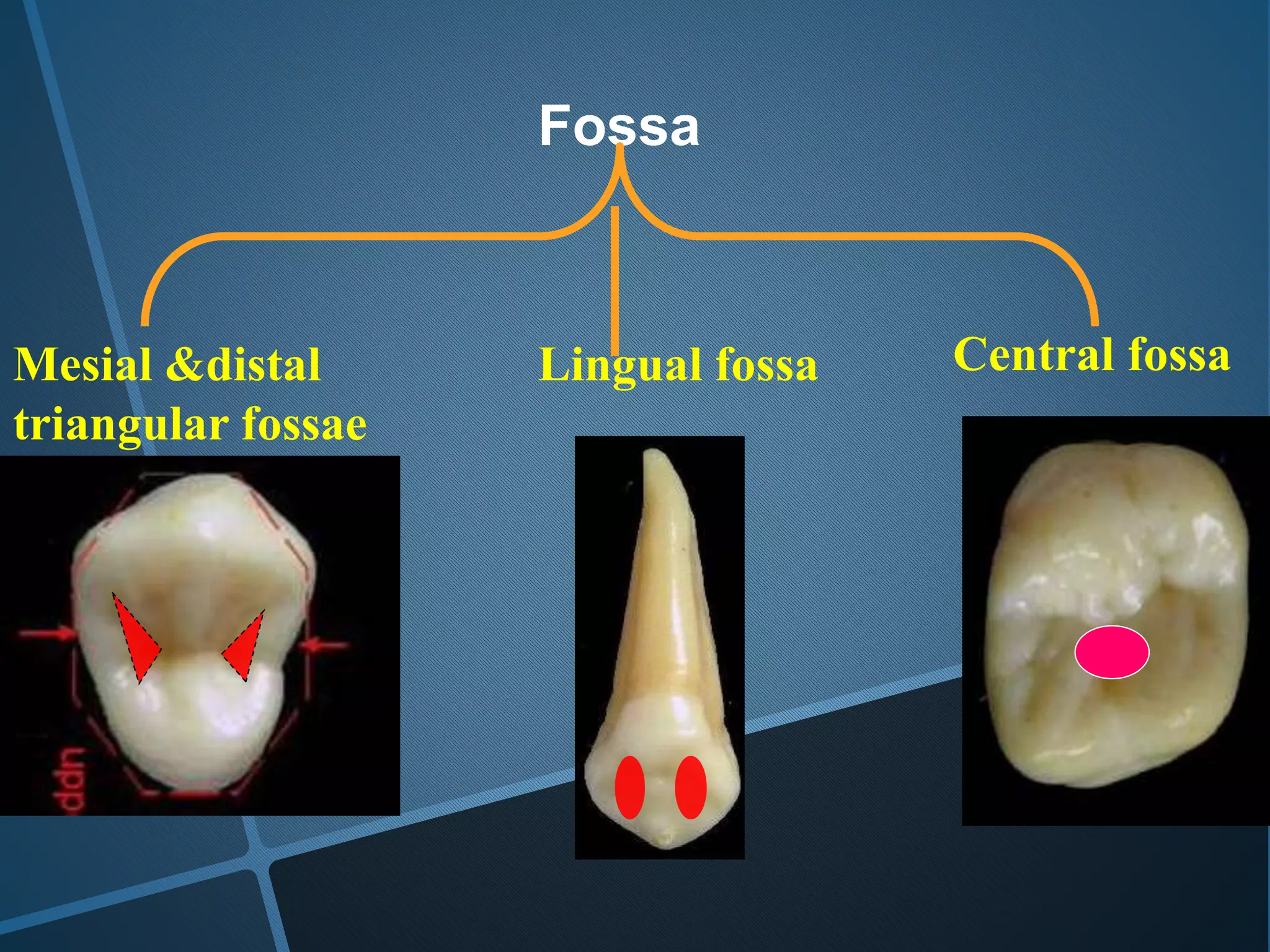 Lingual fossaMesial &distal
triangular fossae
Central fossa
Fossa
 