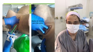 Apoio da ventosa
para não soltar
 