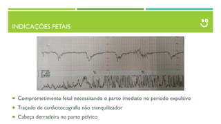 INDICAÇÕES FETAIS
 Comprometimento fetal necessitando o parto imediato no período expulsivo
 Traçado de cardiotocografia não tranquilizador
 Cabeça derradeira no parto pélvico
 