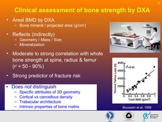 Fragility Fractures - Pathogenesis-Biomechanical View | PPT