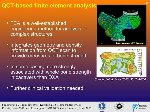 Fragility Fractures - Pathogenesis-Biomechanical View | PPT