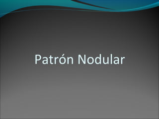 Patrón Nodular
 