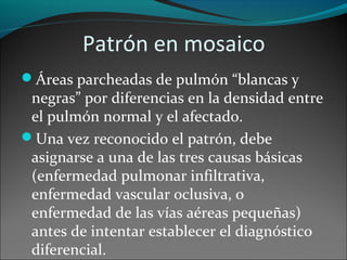 Patrón en mosaico
Áreas parcheadas de pulmón “blancas y
negras” por diferencias en la densidad entre
el pulmón normal y el afectado.
Una vez reconocido el patrón, debe
asignarse a una de las tres causas básicas
(enfermedad pulmonar infiltrativa,
enfermedad vascular oclusiva, o
enfermedad de las vías aéreas pequeñas)
antes de intentar establecer el diagnóstico
diferencial.
 