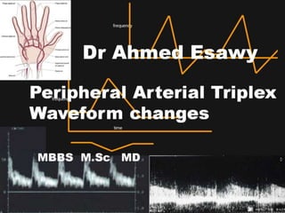 2 peripheral arterial triplex ultrasound waveform change dr ahmed esawy