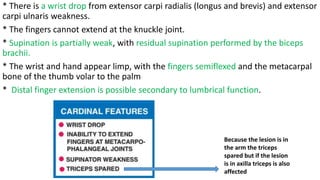 * There is a wrist drop from extensor carpi radialis (longus and brevis) and extensor
carpi ulnaris weakness.
* The fingers cannot extend at the knuckle joint.
* Supination is partially weak, with residual supination performed by the biceps
brachii.
* The wrist and hand appear limp, with the fingers semiflexed and the metacarpal
bone of the thumb volar to the palm
* Distal finger extension is possible secondary to lumbrical function.
Because the lesion is in
the arm the triceps
spared but if the lesion
is in axilla triceps is also
affected
 