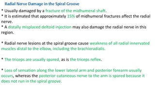 * Usually damaged by a fracture of the midhumeral shaft.
* It is estimated that approximately 15% of midhumeral fractures affect the radial
nerve.
* A distally misplaced deltoid injection may also damage the radial nerve in this
region.
* Radial nerve lesions at the spiral groove cause weakness of all radial innervated
muscles distal to the elbow, including the brachioradialis.
* The triceps are usually spared, as is the triceps reflex.
* Loss of sensation along the lower lateral arm and posterior forearm usually
occurs, whereas the posterior cutaneous nerve to the arm is spared because it
does not run in the spiral groove.
 
