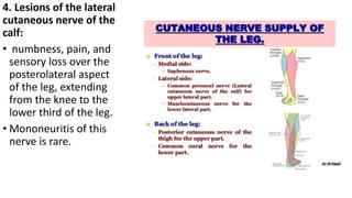 4. Lesions of the lateral
cutaneous nerve of the
calf:
• numbness, pain, and
sensory loss over the
posterolateral aspect
of the leg, extending
from the knee to the
lower third of the leg.
• Mononeuritis of this
nerve is rare.
 