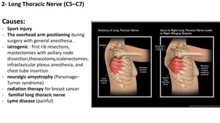 2- Long Thoracic Nerve (C5–C7)
Causes:
- Sport injury
- The overhead arm positioning during
surgery with general anesthesia .
- iatrogenic : first rib resections,
mastectomies with axillary node
dissection,thoracotomy,scalenectomies,
infraclavicular plexus anesthesia, and
chest tube insertion
- neuralgic amyotrophy (Parsonage–
Turner syndrome)
- radiation therapy for breast cancer
- familial long thoracic nerve
- Lyme disease (painful)
 