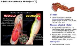 7- Musculocutaneous Nerve (C5–C7)
 