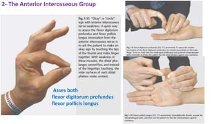 2- The Anterior Interosseous Group
Asses both
flexor digitorum profundus
flexor pollicis longus
 