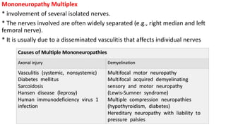 Mononeuropathy Multiplex
* involvement of several isolated nerves.
* The nerves involved are often widely separated (e.g., right median and left
femoral nerve).
* It is usually due to a disseminated vasculitis that affects individual nerves
 