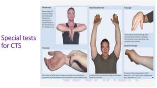 Special tests
for CTS
 