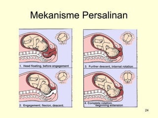 Mekanisme Persalinan




                       24
 