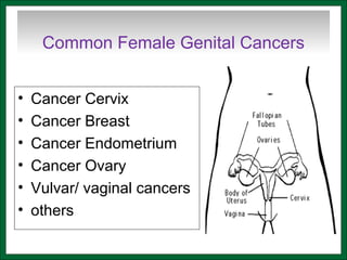 Common Female Genital Cancers
• Cancer Cervix
• Cancer Breast
• Cancer Endometrium
• Cancer Ovary
• Vulvar/ vaginal cancers
• others
 