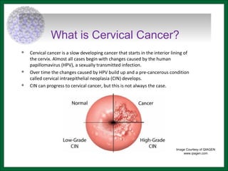 What is Cervical Cancer?
 Cervical cancer is a slow developing cancer that starts in the interior lining of
the cervix. Almost all cases begin with changes caused by the human
papillomavirus (HPV), a sexually transmitted infection.
 Over time the changes caused by HPV build up and a pre-cancerous condition
called cervical intraepithelial neoplasia (CIN) develops.
 CIN can progress to cervical cancer, but this is not always the case.
Image Courtesy of QIAGEN
www.qiagen.com
 