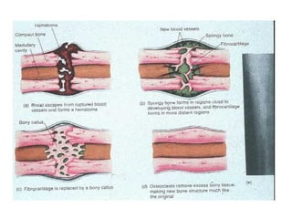 2- Principles_of_fractures for physiotherapy .ppt