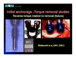 Klokkevold et al,1997; 2001)
 