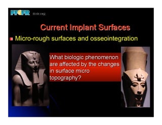 "   Micro-rough   surfaces and osseointegration
 
