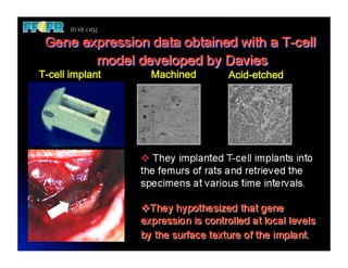T-cell implant   Machined   Acid-etched
 