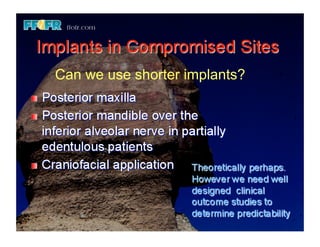 Can we use shorter implants?
 