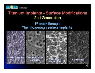 Titanium Implants - Surface Modifications
                        2nd Generation
                    1st break through
             The micro-rough surface implants




Ti Grit blasted   Electrolytically
                                     Sand blast-   Acid etched
                    enhanced
                                     acid etched
 