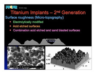Titanium Implants – 2nd Generation
Surface roughness (Micro-topography)
    Electrolytically modified
    Acid etched surfaces
    Combination acid etched and sand blasted surfaces


                            1 micron
 