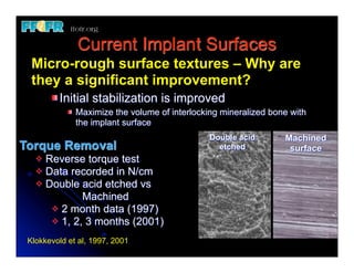 Current Implant Surfaces
	
 Micro-rough surface textures – Why are
   they a significant improvement?
         Initial stabilization is improved
              Maximize the volume of interlocking mineralized bone with
              the implant surface
                                               Double acid       Machined
Torque Removal                                   etched           surface
   v Reverse torque test
   v Data recorded in N/cm
   v Double acid etched vs
   	
          Machined
       v 2 month data (1997)
       v 1, 2, 3 months (2001)

 Klokkevold et al, 1997, 2001
 