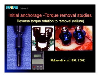 Initial anchorage -Torque removal studies
    Reverse torque rotation to removal (failure)




                          Klokkevold et al,1997; 2001)
 