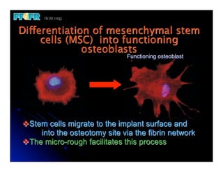 Differentiation of mesenchymal stem
     cells (MSC) into functioning
              osteoblasts
                              Functioning osteoblast




vStem cells migrate to the implant surface and
	
   into the osteotomy site via the fibrin network
vThe micro-rough facilitates this process
 