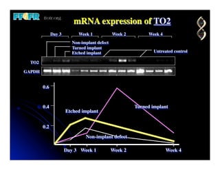 mRNA expression of TO2
              Day 3        Week 1            Week 2        Week 4
                        Non-implant defect
                        Turned implant
                        Etched implant                       Untreated control

  TO2

GAPDH


        0.6


        0.4                                           Turned implant
                      Etched implant


        0.2
                              Non-implant defect

                      Day 3 Week 1           Week 2                 Week 4
 