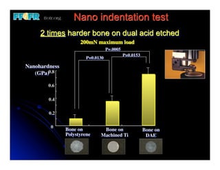 Nano indentation test
     2 times harder bone on dual acid etched
                     200mN maximum load
                                   P=.0005
                                             P=0.0153
                        P=0.0130
Nanohardness
   (GPa)0.8

        0.6

        0.4

        0.2

         0
               Bone on         Bone on                  Bone on
               Polystyrene    Machined Ti                DAE
 