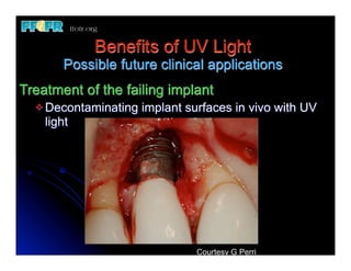 Benefits of UV Light
       Possible future clinical applications
Treatment of the failing implant
  v Decontaminating   implant surfaces in vivo with UV
    light




                                 Courtesy G Perri
 
