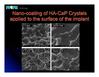 Nano-coating of HA-CaP Crystals
applied to the surface of the implant
 