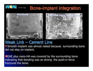 Bone-implant integration
         Machined               DAE+HA-nano-topography


                                                 bone




Weak Link – Cement Line
  Smooth implant was almost naked because surrounding bone
did not stay on implant.

  DAE plus nano-HA was covered by the surrounding bone
indicating that bonding was so strong the push-in force
fractured the bone.
 