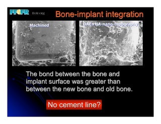 Bone-implant integration
 Machined          DAE+HA-nano-topography



                                  bone




The bond between the bone and
implant surface was greater than
between the new bone and old bone.

        No cement line?
 
