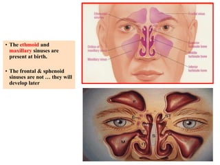 • The ethmoid and 
maxillary sinuses are 
present at birth. 
• The frontal & sphenoid 
sinuses are not … they will 
develop later 
 