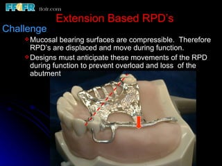 2.rpd biomechanics | PPT