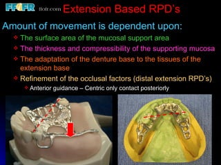 Latice Base Rpd 2.rpd biomechanics | PPT