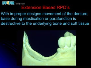 2.rpd biomechanics | PPT