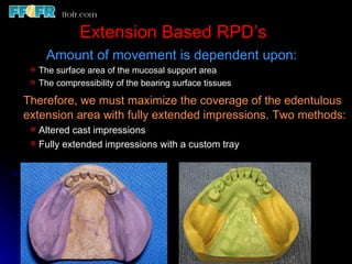 2.rpd biomechanics | PPT