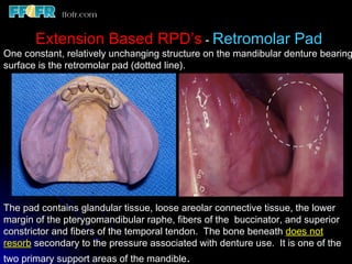 Flexbasd Rpd 2.rpd biomechanics | PPT