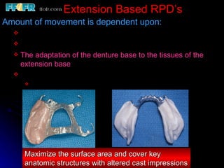 2.rpd biomechanics | PPT
