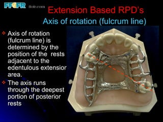 Posterior Rpd 2.rpd biomechanics | PPT